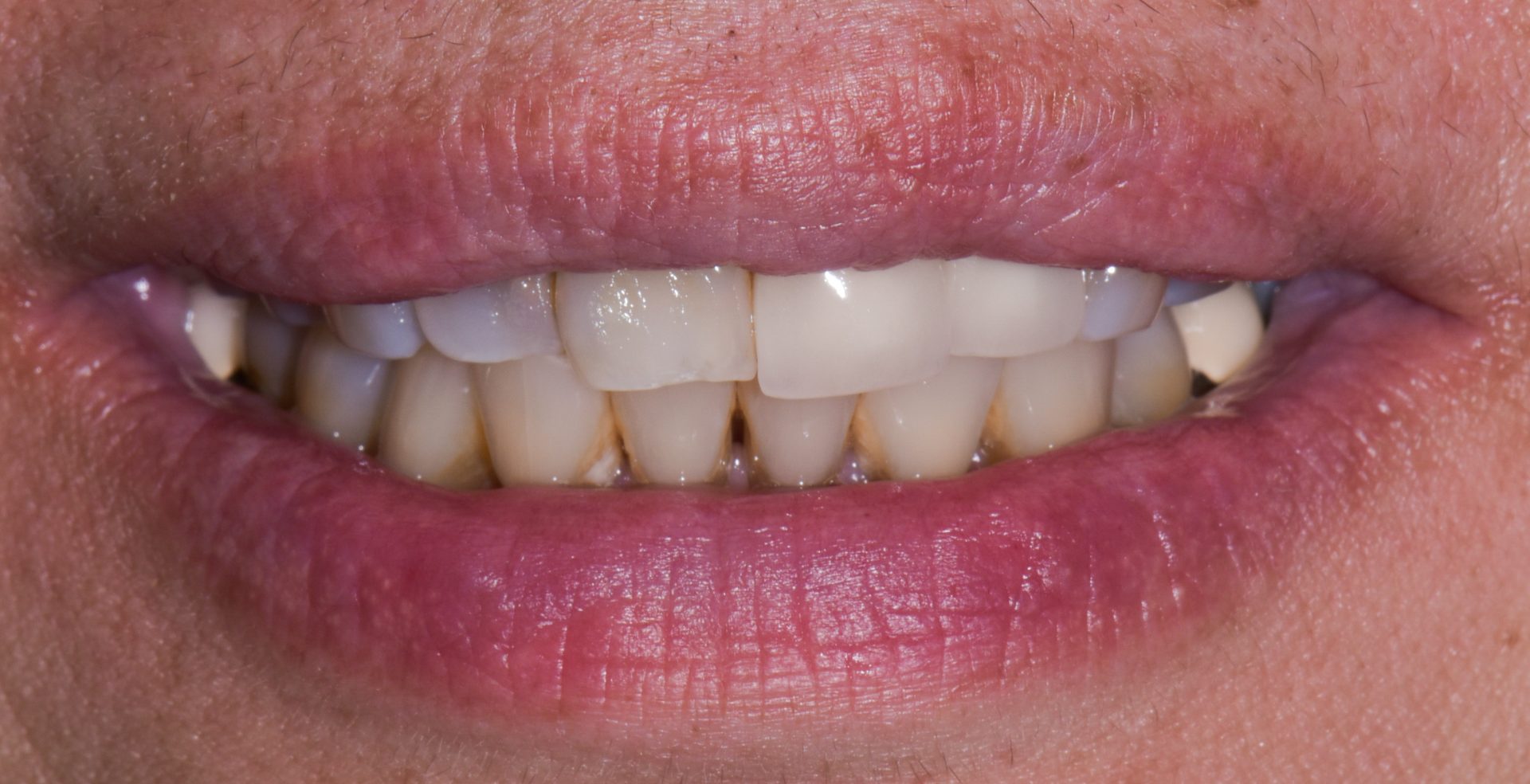 Dentist Pembroke Pines FL