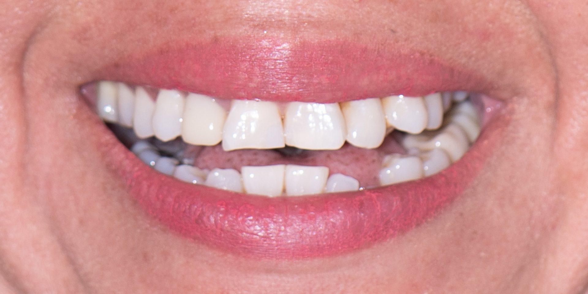 Dentist Pembroke Pines FL