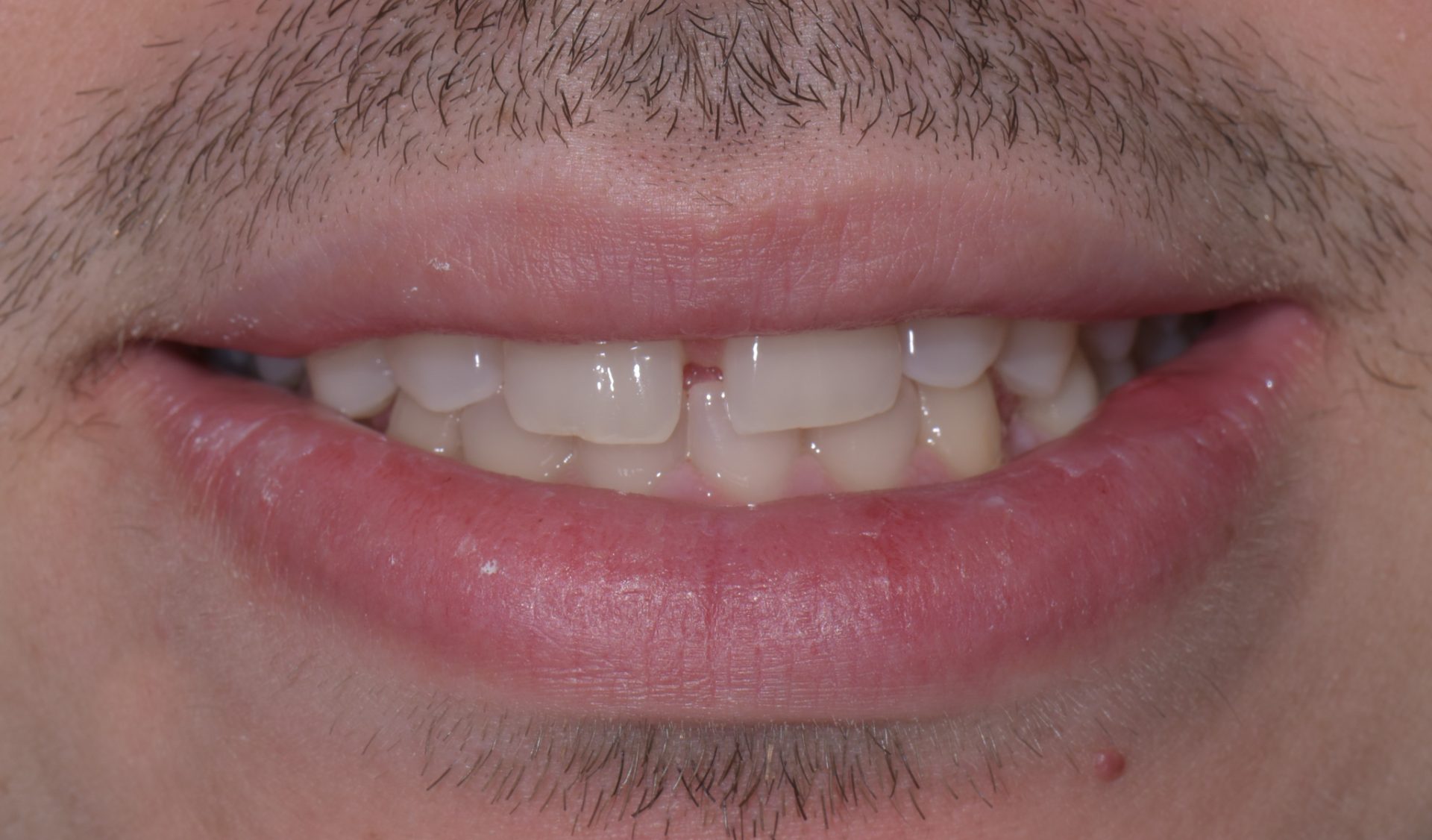 Dentist Pembroke Pines FL