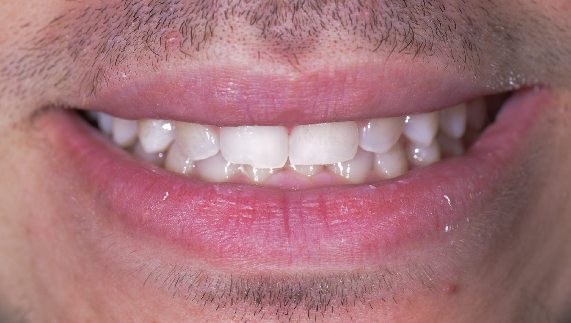 Dentist Pembroke Pines FL