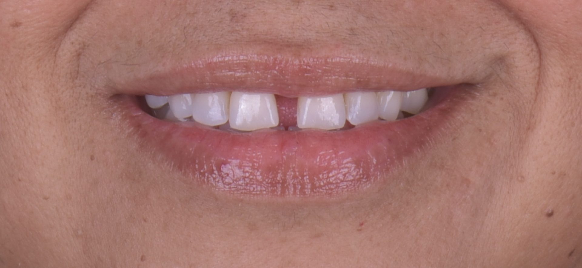 Dentist Pembroke Pines FL