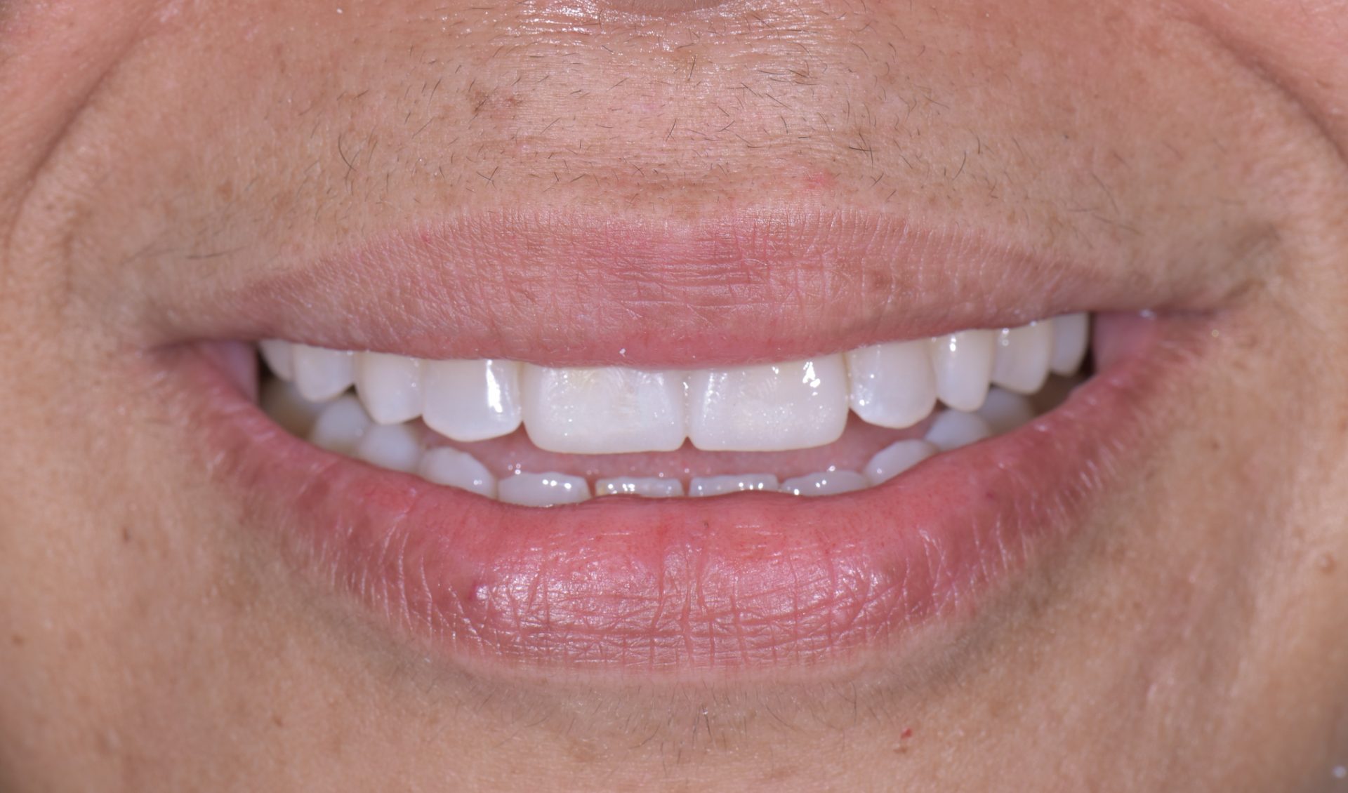 Dentist Pembroke Pines FL