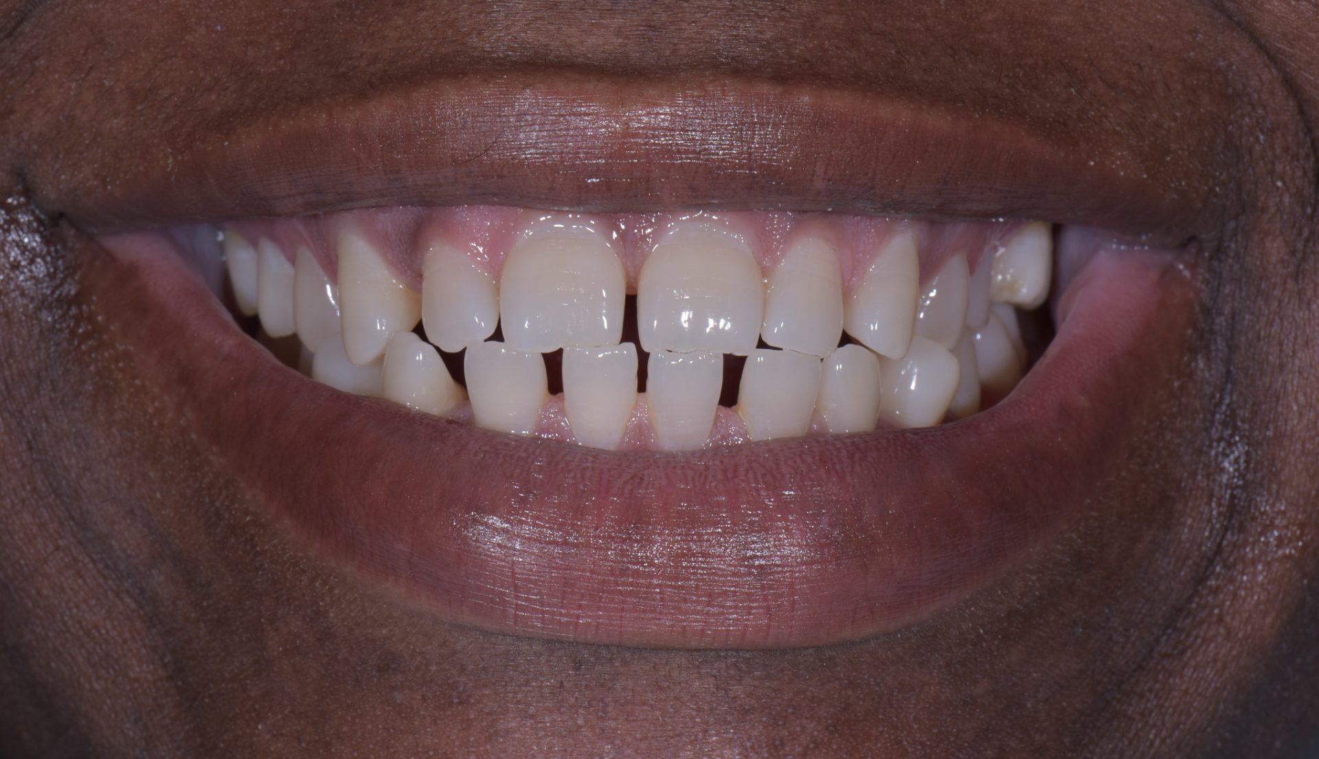 Dentist Pembroke Pines FL