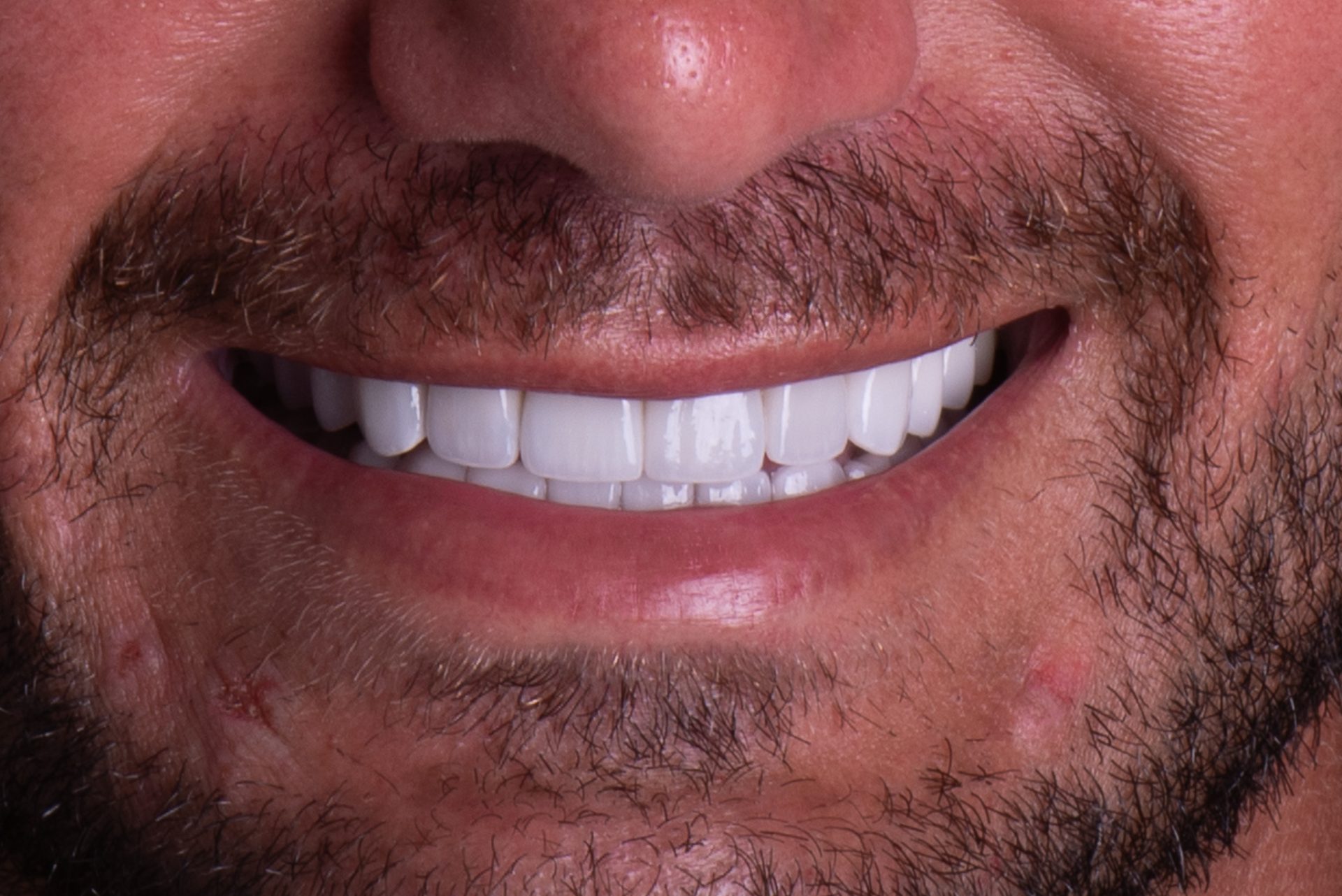 Dentist Pembroke Pines FL