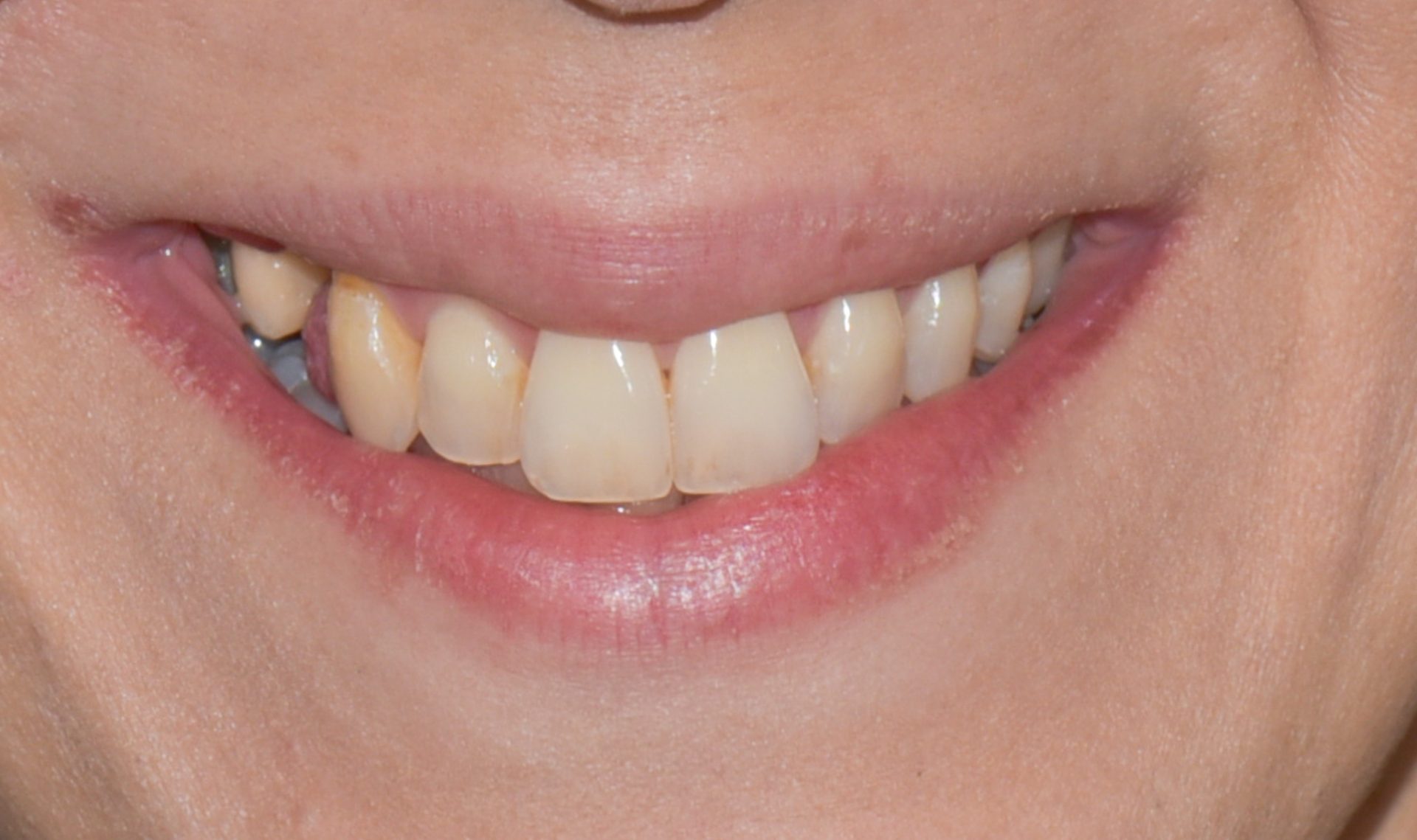 Dentist Pembroke Pines FL