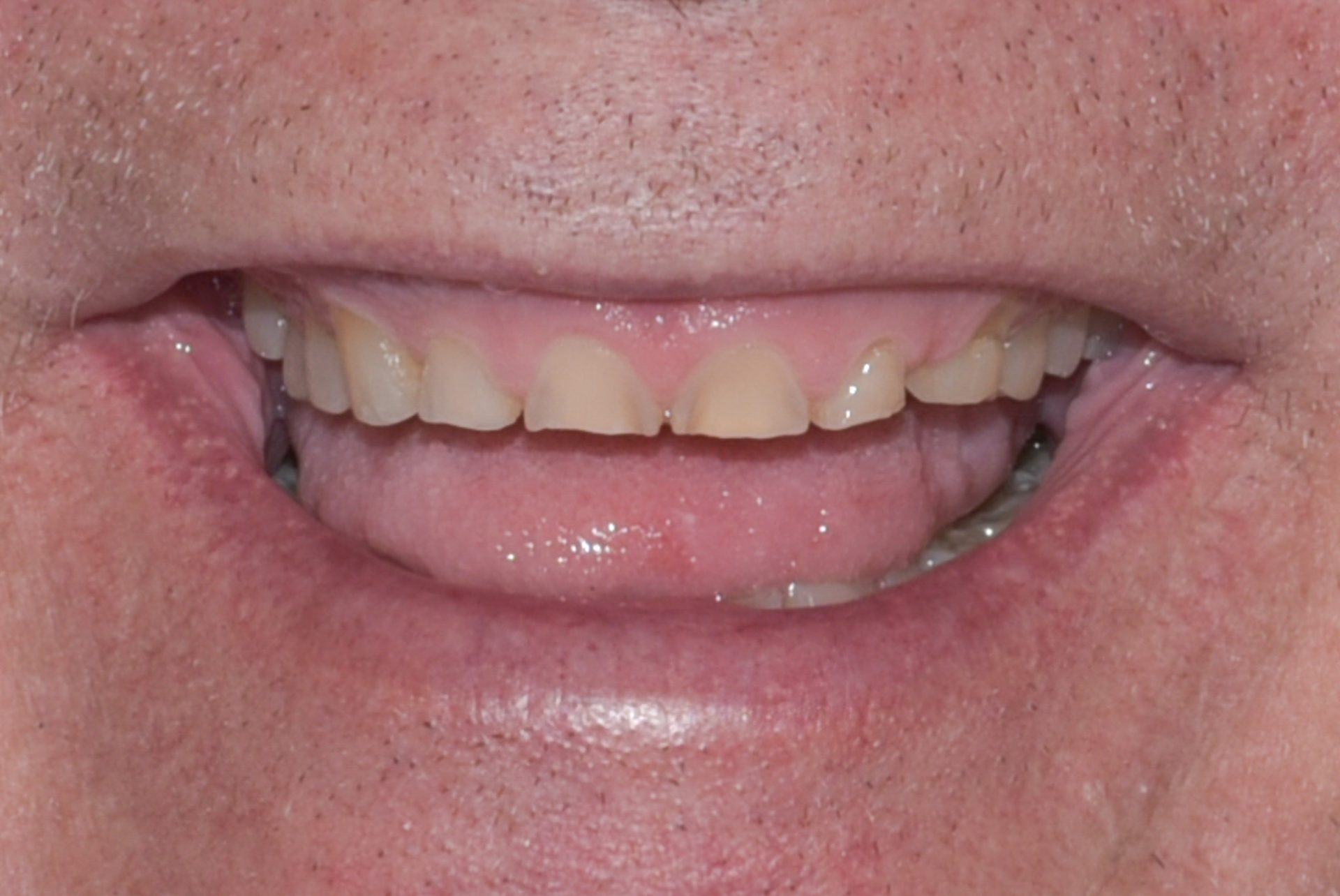 Dentist Pembroke Pines FL