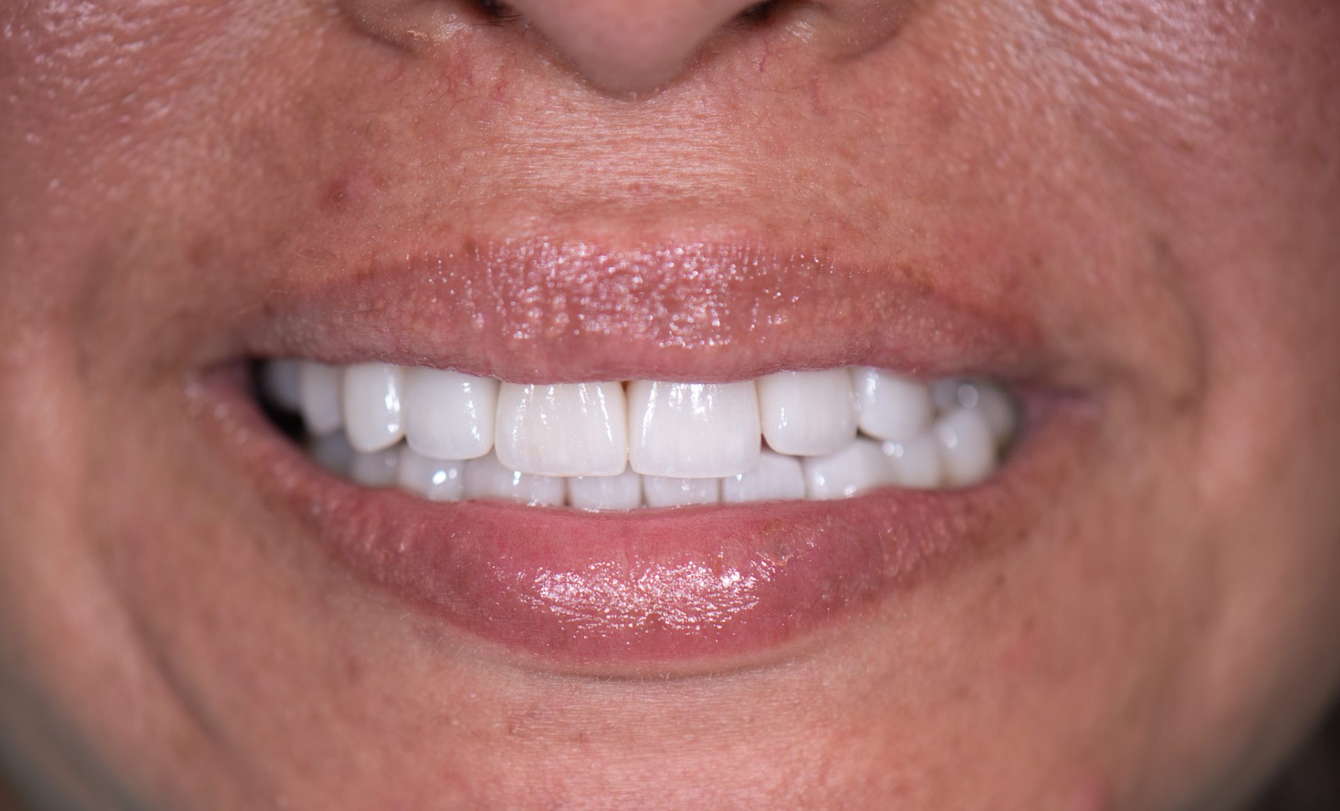 Dentist Pembroke Pines FL