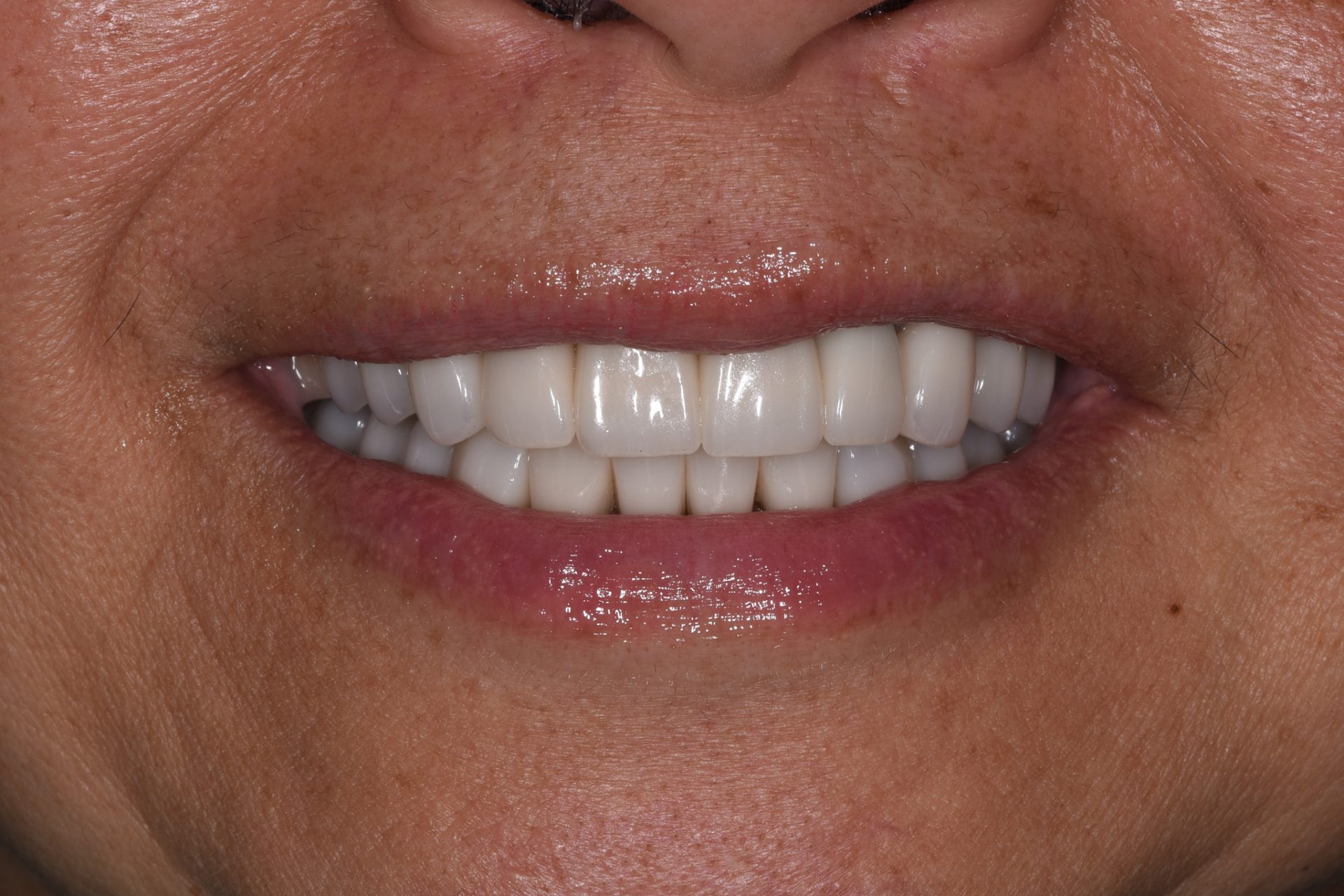 Dentist Pembroke Pines FL