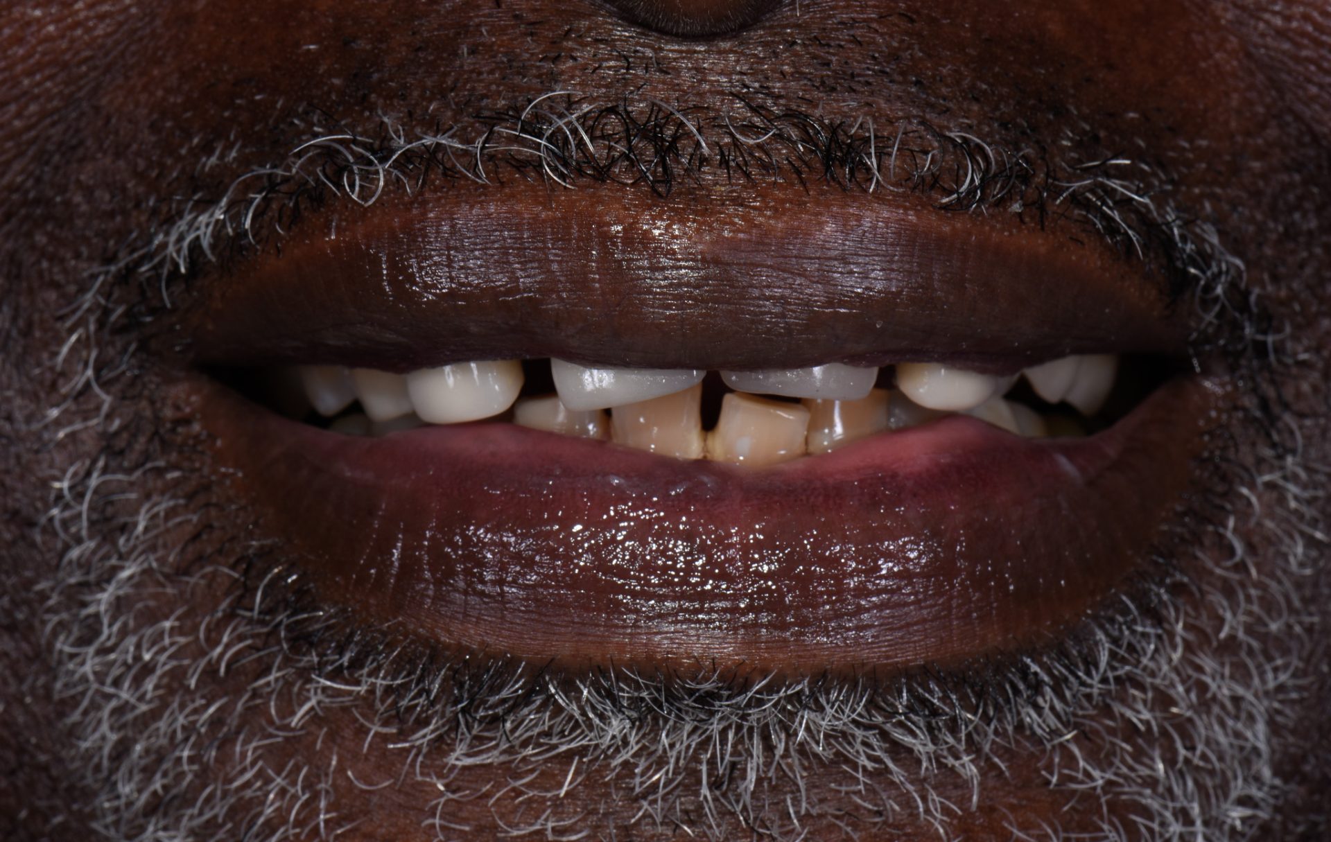 Dentist Pembroke Pines FL