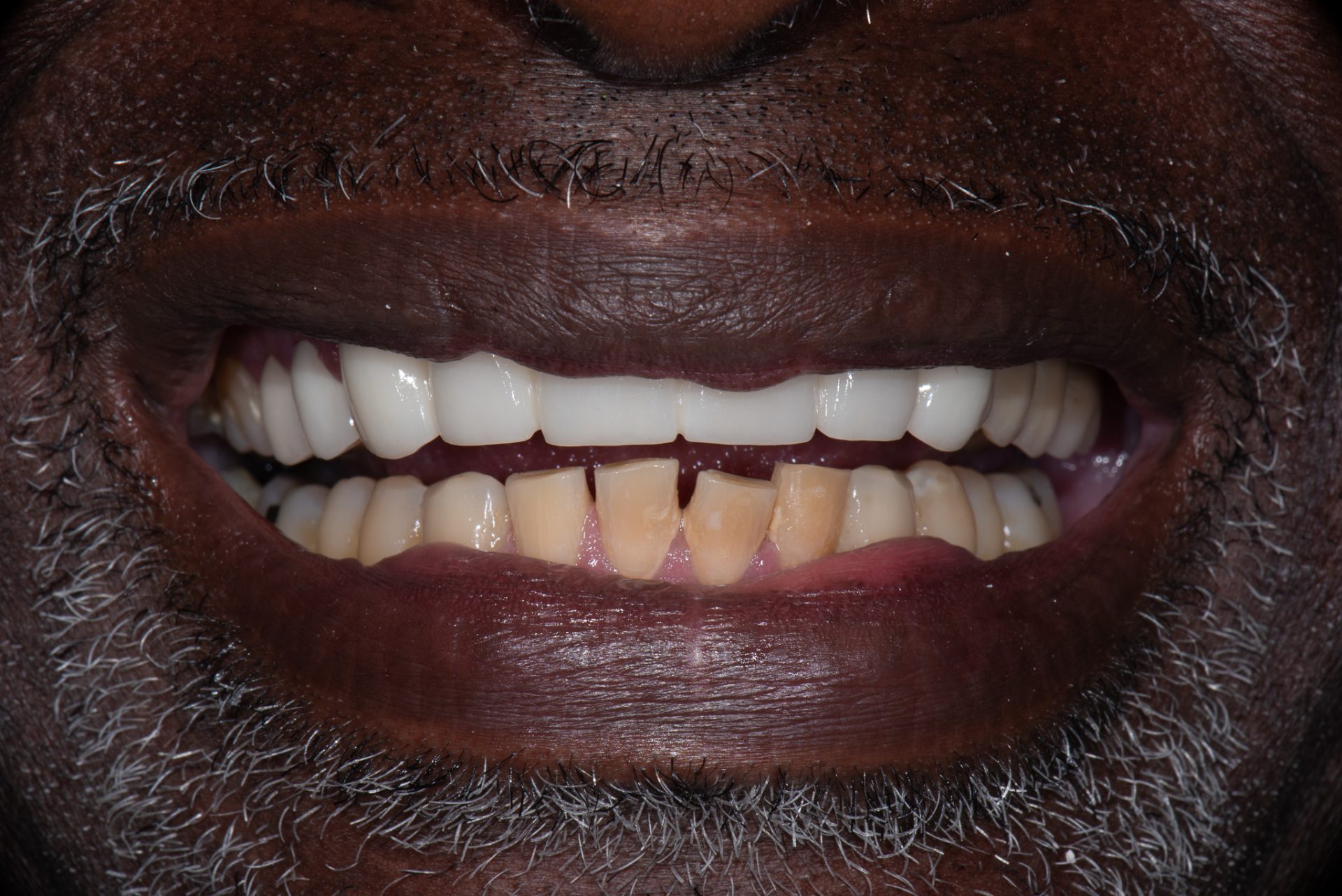 Dentist Pembroke Pines FL