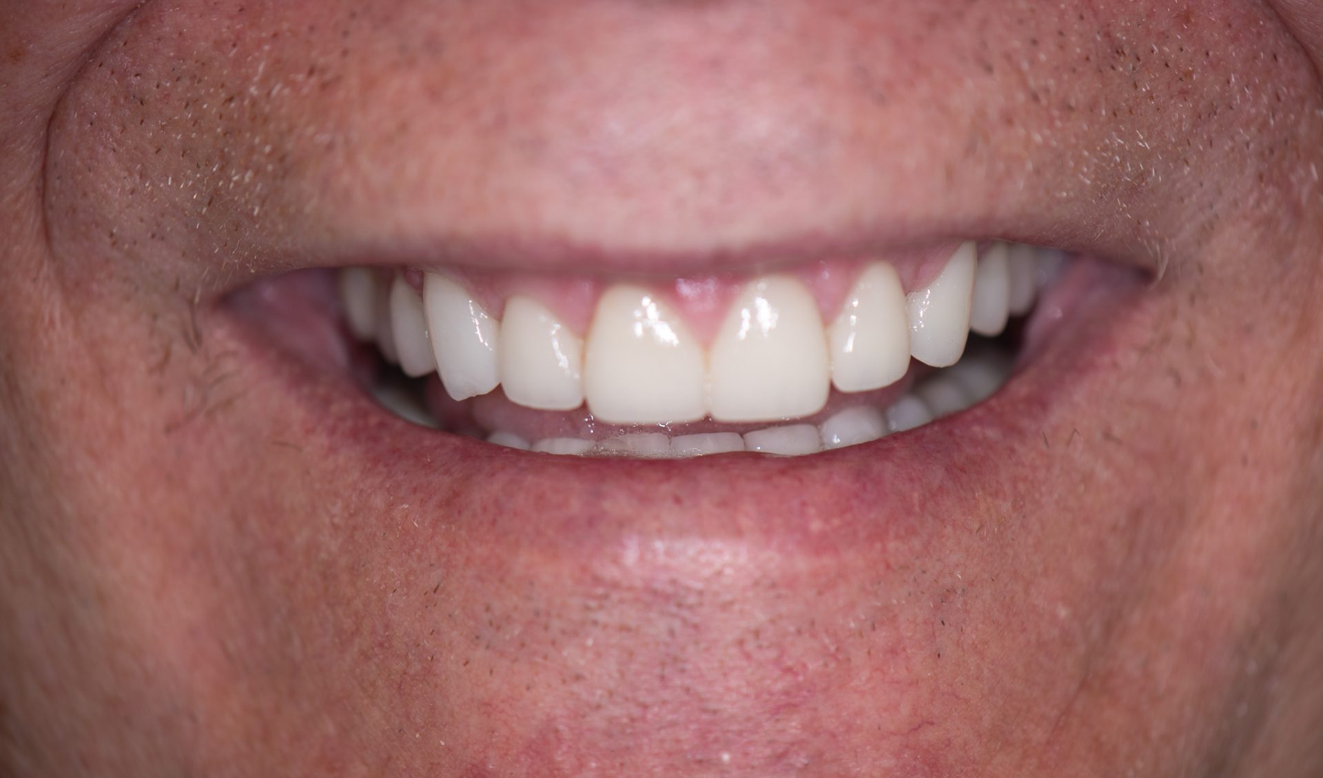 Dentist Pembroke Pines FL