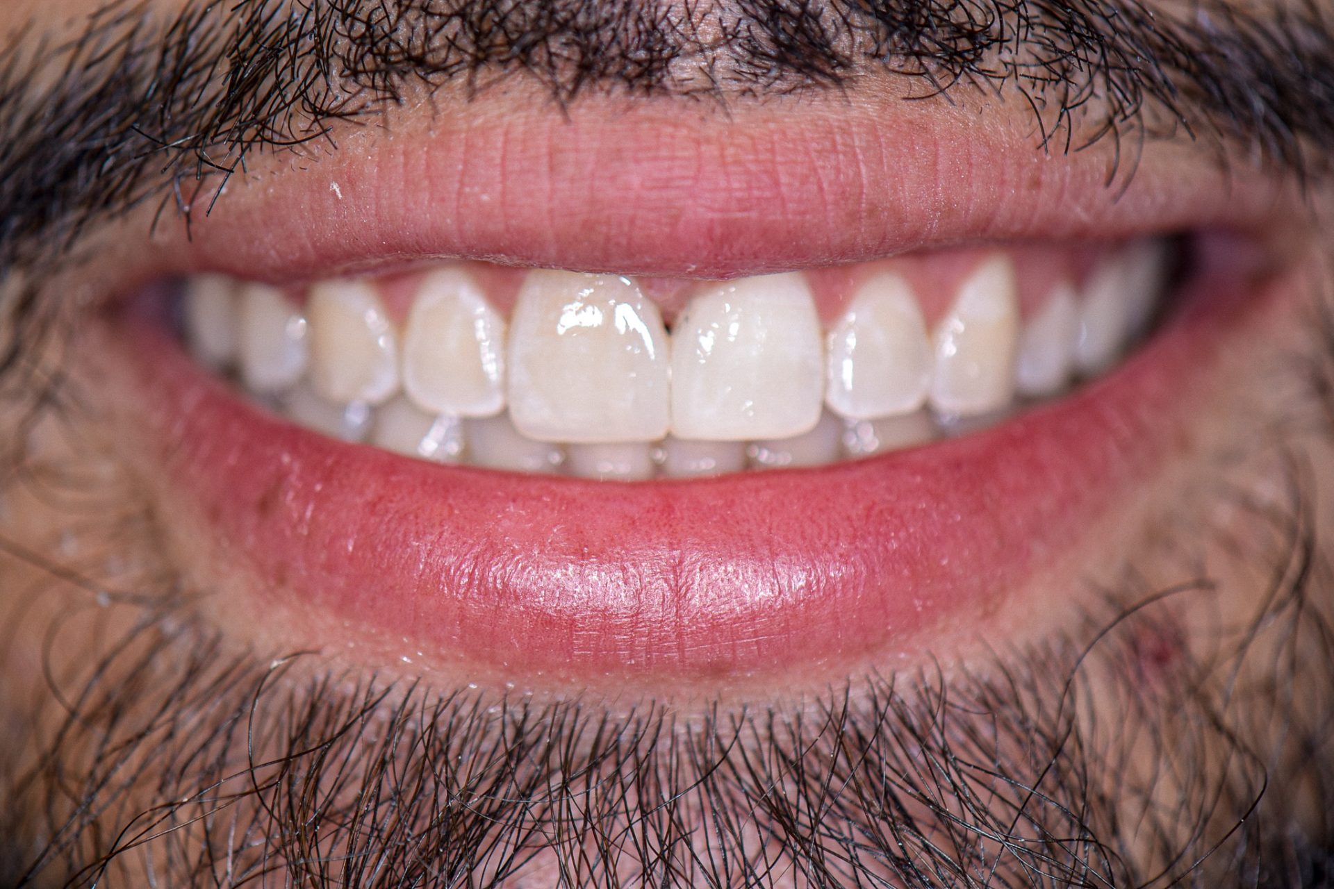 Dentist Pembroke Pines FL