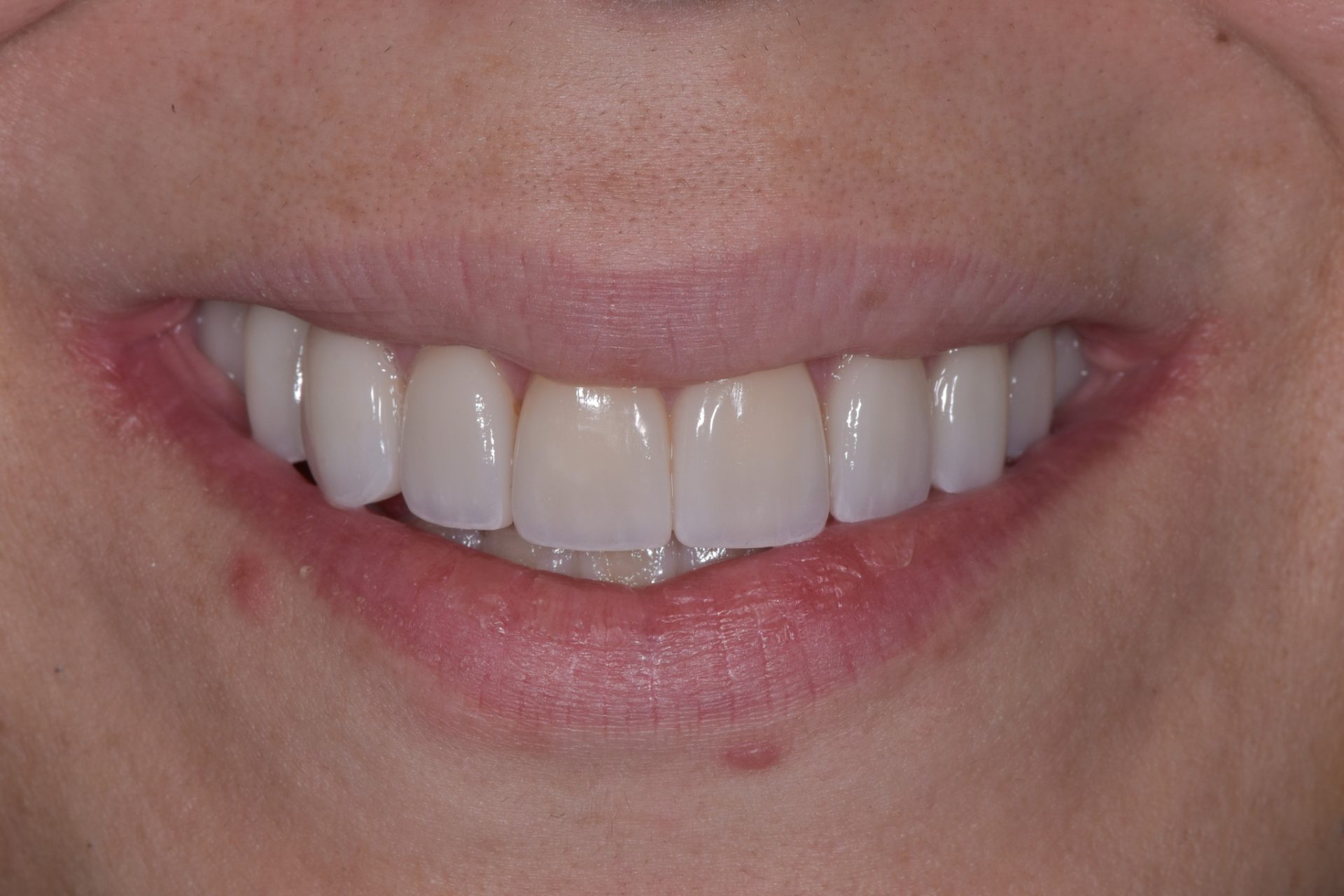 Dentist Pembroke Pines FL