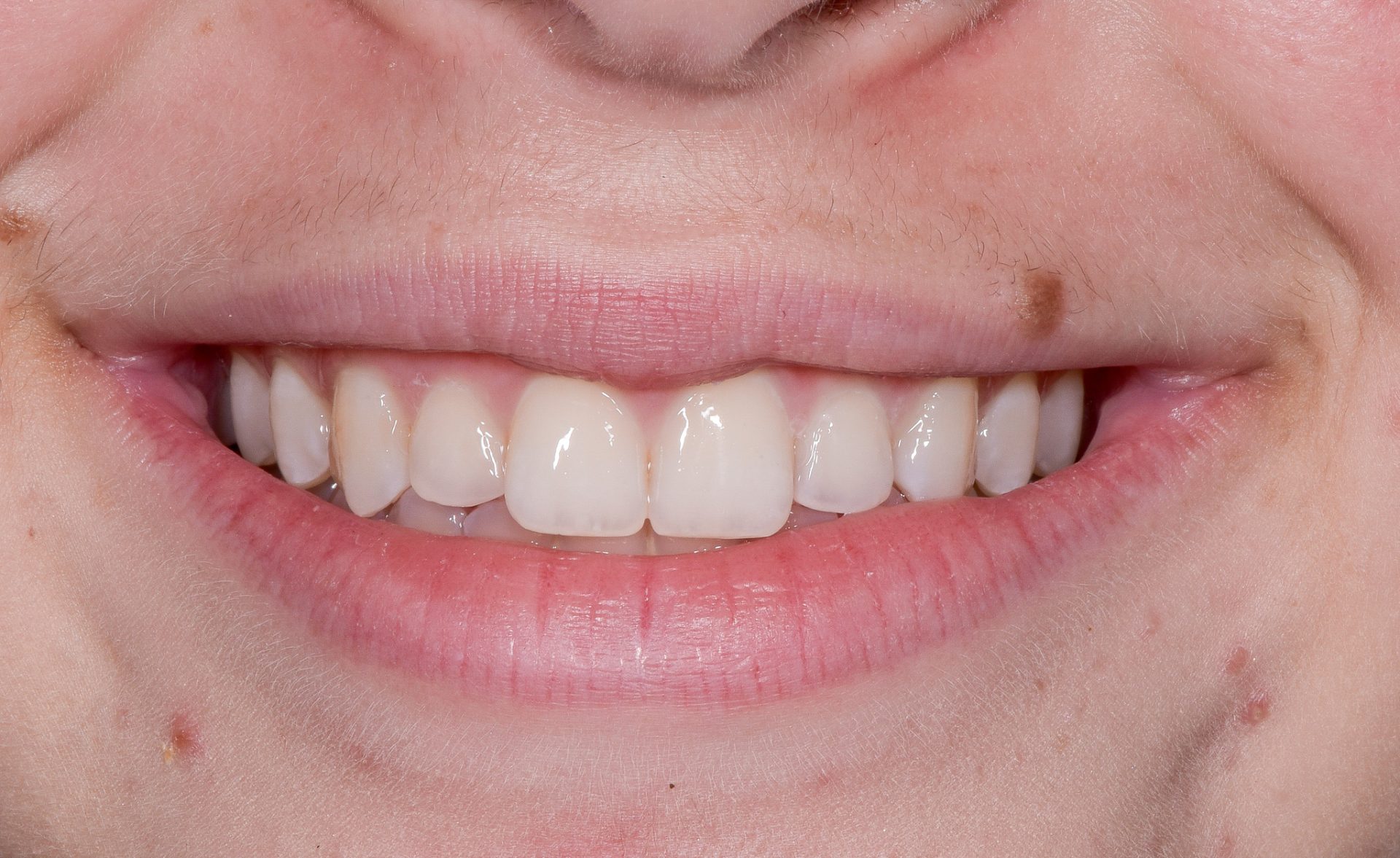 Dentist Pembroke Pines FL