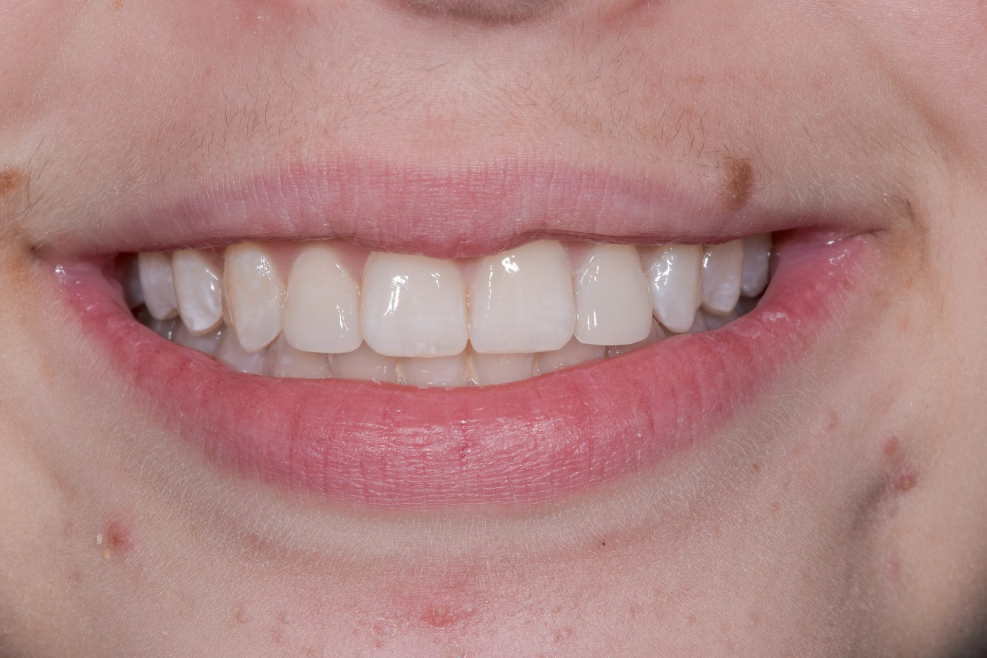 Dentist Pembroke Pines FL